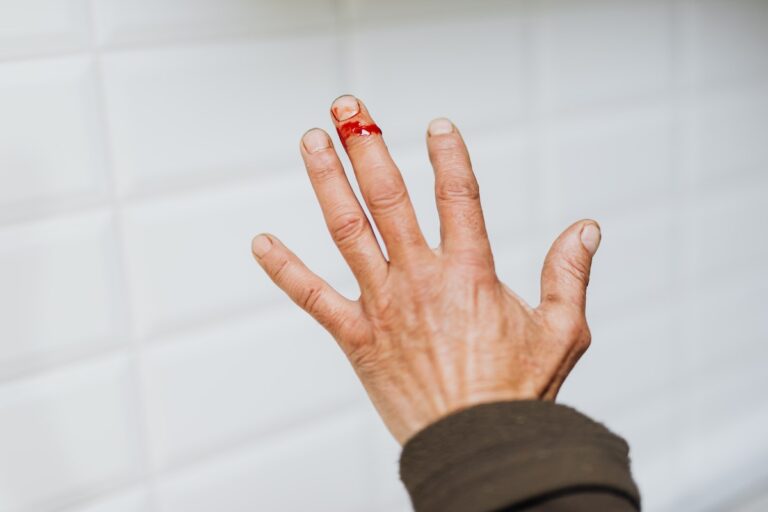 Crop person with bleeding wound on finger